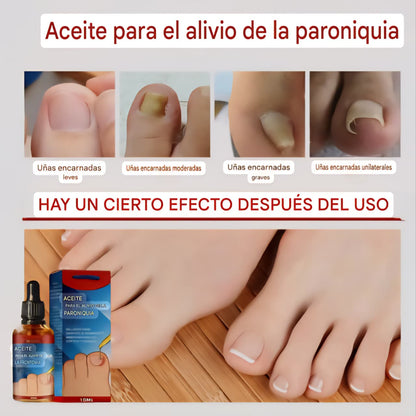 2x1 ToenailPlus ™ | Anti hongos pies